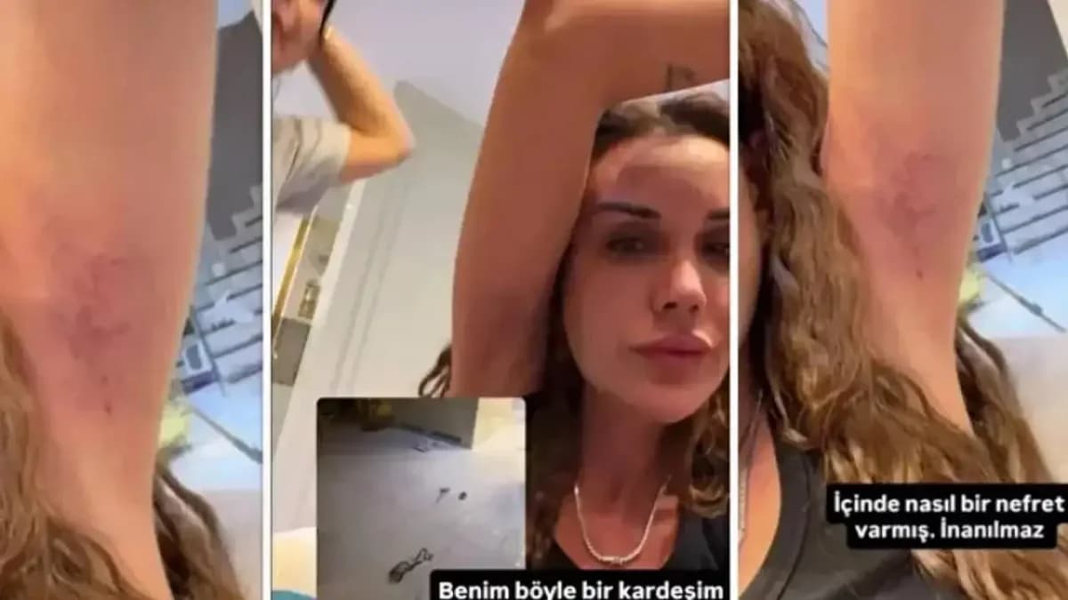 Dilan Polat darp edildiği görüntüleri sosyal medyada paylaştı