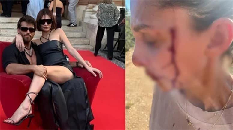 Can Yaman destek oldu: Sara Bluma’dan eski sevgiliye şiddet suçlaması