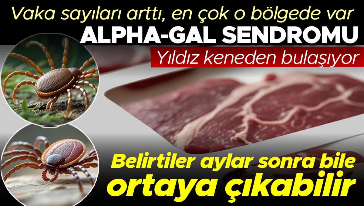 Alfa-gal Sendromu Artıyor: Kene Isırığıyla Gelen Et ve Süt Alerjisi!