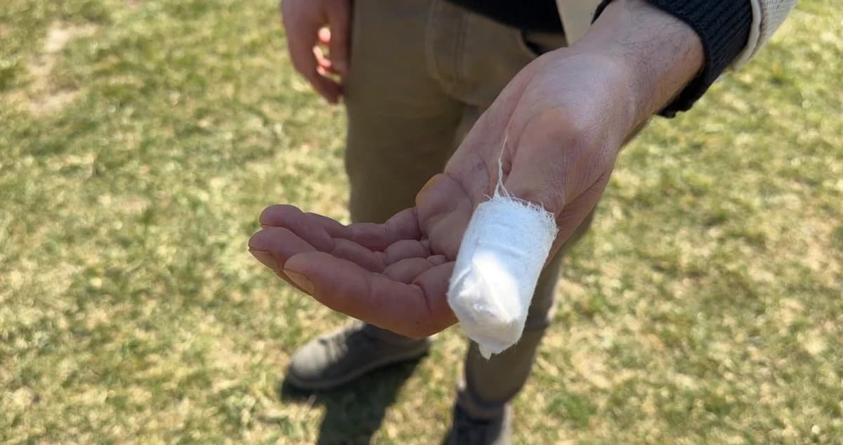 Karabük’te Başıboş Pitbull Saldırısı: Yalçın Açıkgöz ve Köpeği ‘Şans’ Yaralandı
