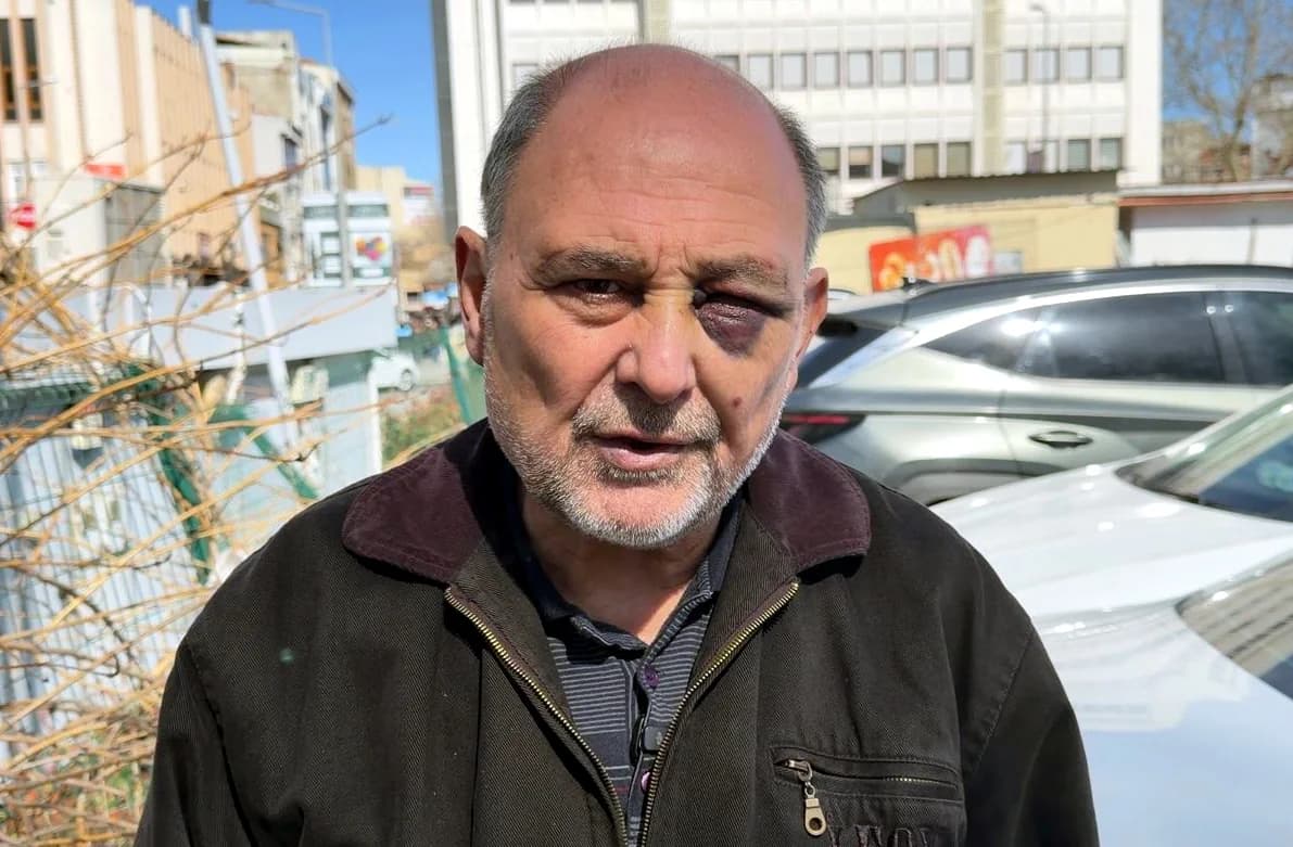 Cenaze Dönüşü Saldırıya Uğrayan Aydın Taksim: “Çift Görüyorum, Şikayetçiyim”