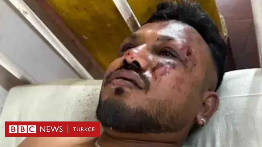 Air India Kazasında 11A Koltuğundan Mucizevi Kurtuluş