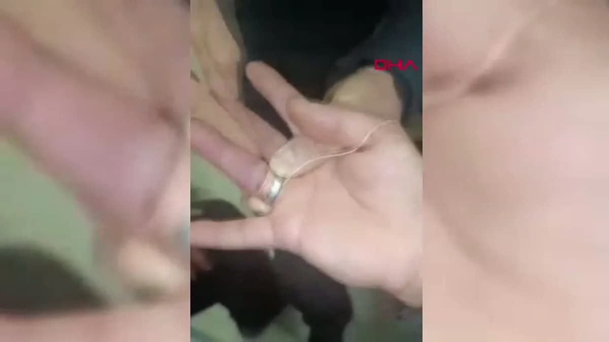 Adıyaman’da Parmağına Sıkışan Yüzük İtfaiye Ekipleri Tarafından Çıkarıldı