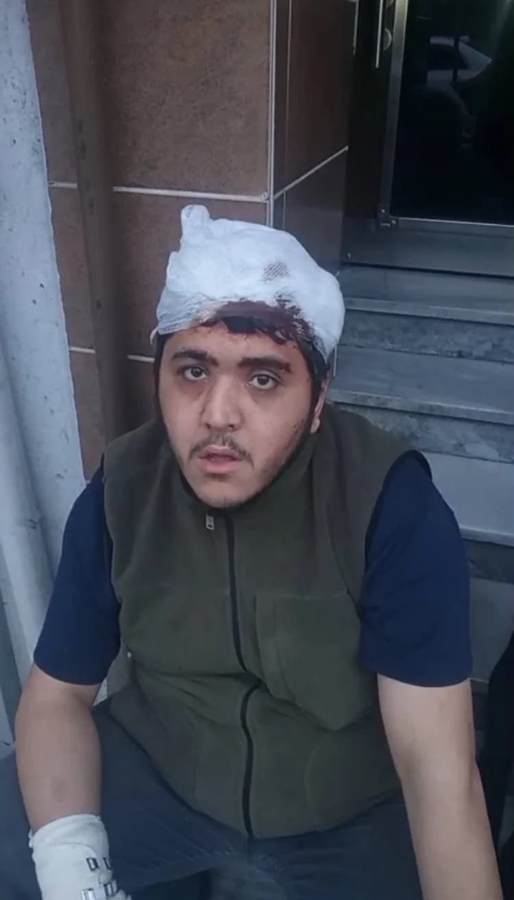 Sultangazi’de Zihinsel Engelli Genç ve Annesine Sopalı Saldırı