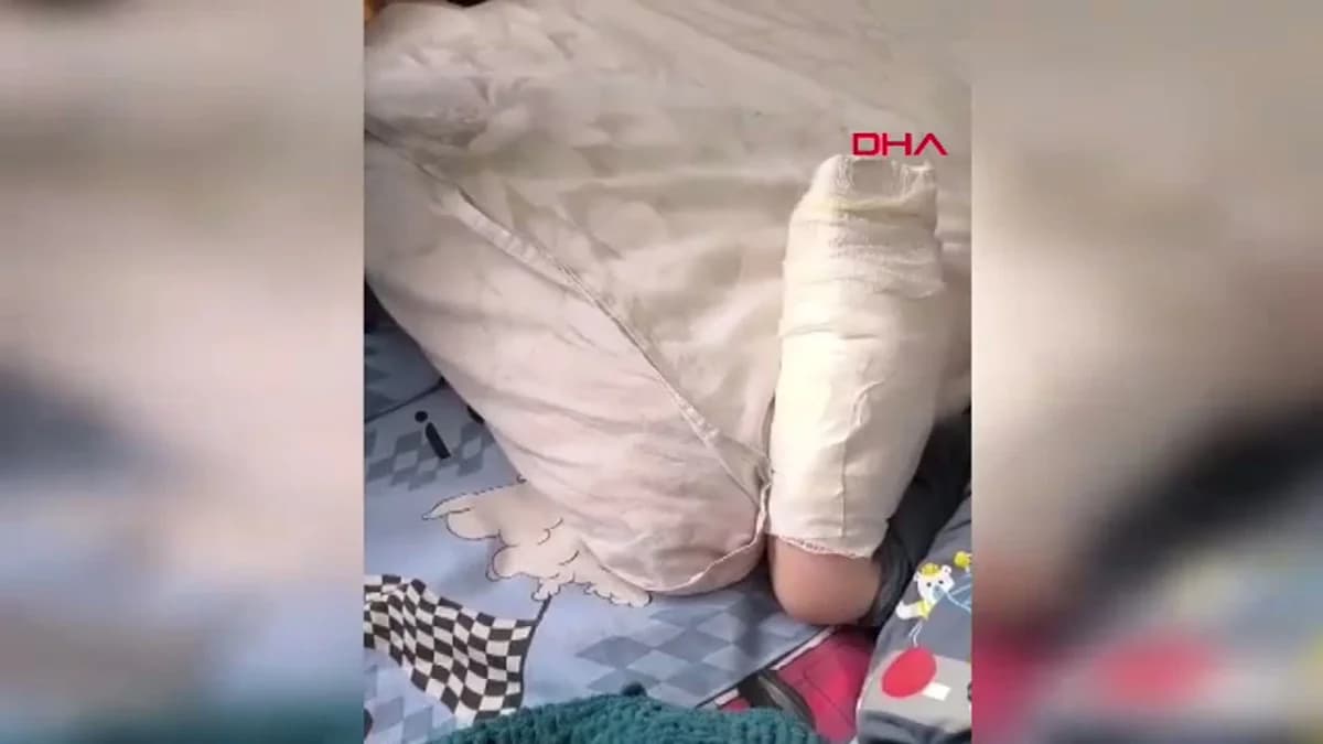 Mardin’deki AVM’de Yürüyen Merdivene Eli Sıkışan Çocuğun Parmağı Kopmuş