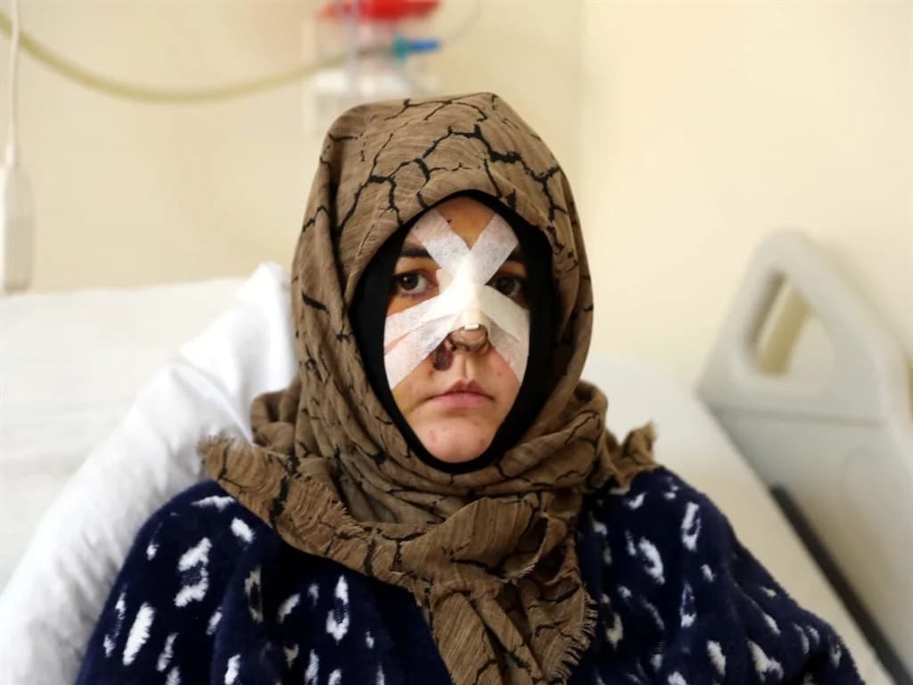 Boşanma Davasında Kaldırım Taşı “Silah” Olarak Değerlendirildi